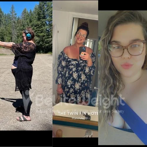 Stephanie. B - gastric sleeve update after 3 years*